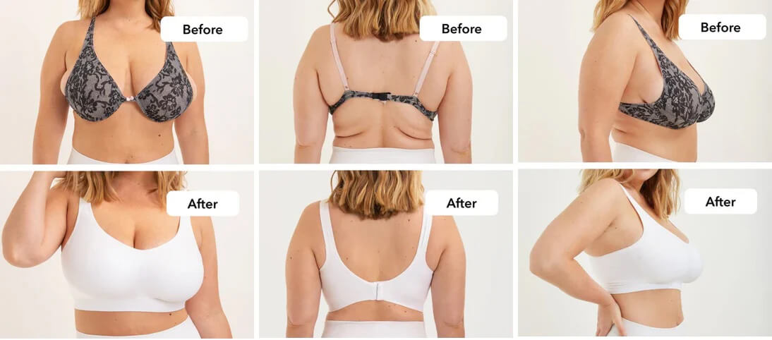 Common bra fit issues Before and After