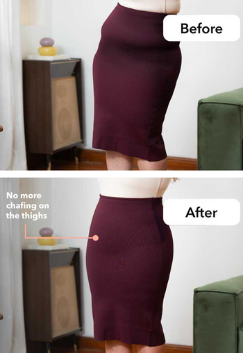 Thigh Smoothing - Before and After