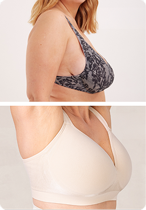 Sweetheart Bra before and after comparison